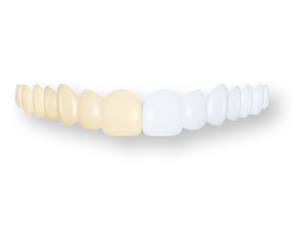 teeth whitening illustration