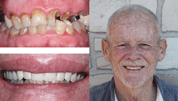 patient results with full face
