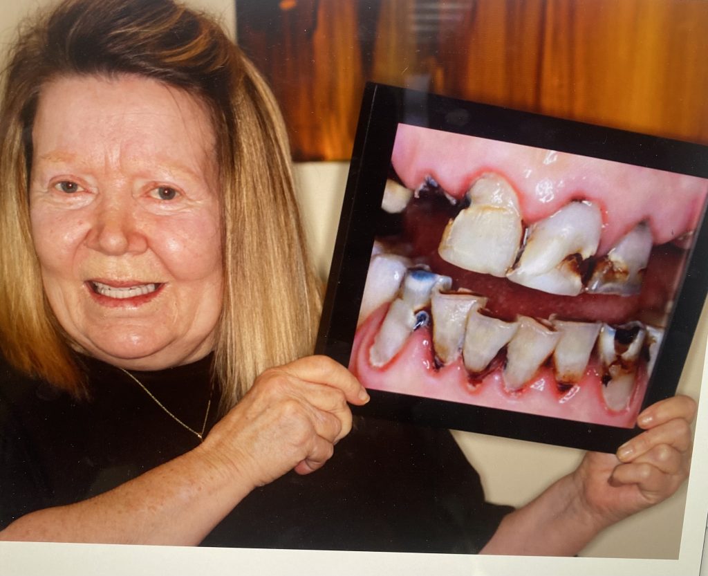 patient holding up a picture of their before smile photo